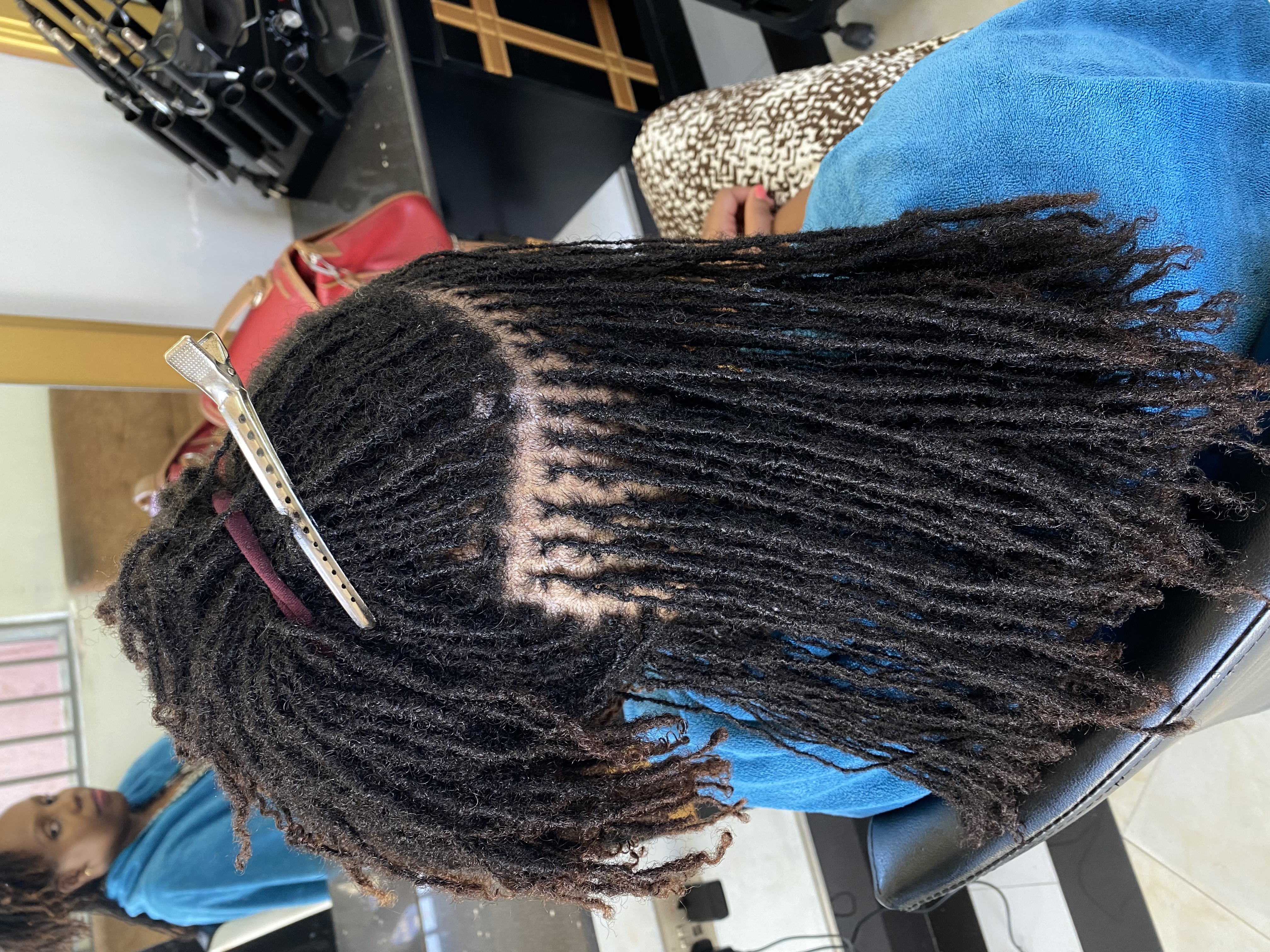 Microlocks Maintenance: It’s More Than Retightening the Roots